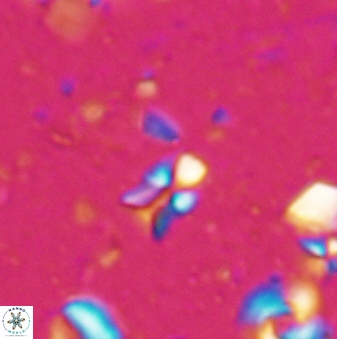 Sphenolithus disbelemnos 27859