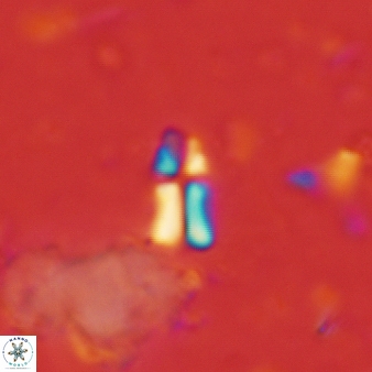 Sphenolithus disbelemnos 297