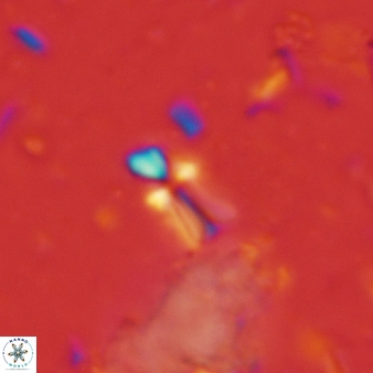 Sphenolithus disbelemnos 298