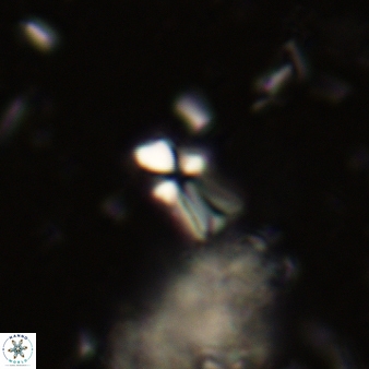 Sphenolithus disbelemnos 299