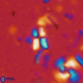 Sphenolithus disbelemnos 54