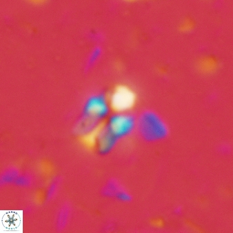 Sphenolithus disbelemnos 60