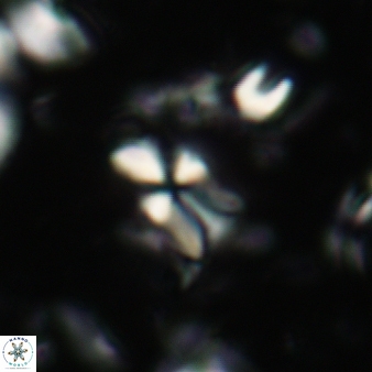 Sphenolithus disbelemnos 63
