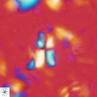 Sphenolithus disbelemnos 66