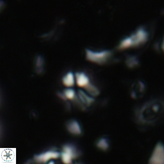 Sphenolithus disbelemnos 67