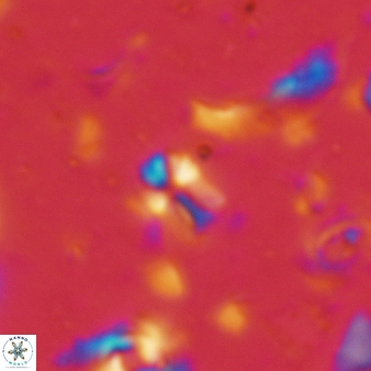 Sphenolithus disbelemnos 68