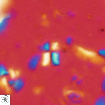 Sphenolithus disbelemnos 69