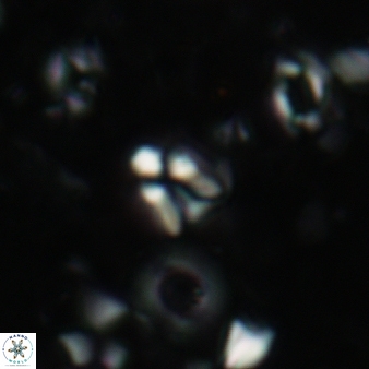 Sphenolithus disbelemnos 70