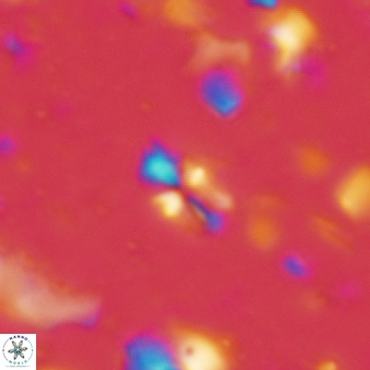 Sphenolithus disbelemnos 92