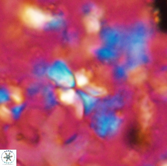 Sphenolithus dissimilis 27825