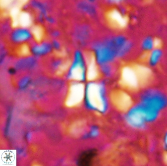 Sphenolithus dissimilis 27828