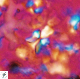 Sphenolithus dissimilis 27829