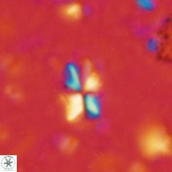 Sphenolithus dissimilis 305