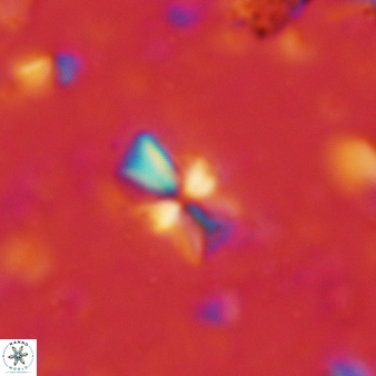 Sphenolithus dissimilis 306
