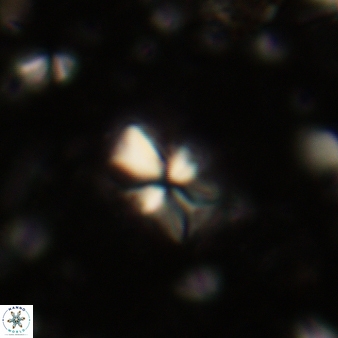 Sphenolithus dissimilis 307