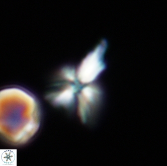 Sphenolithus editus 2000