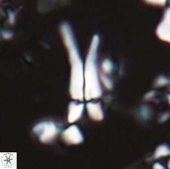 Sphenolithus furcatolithoides 25803