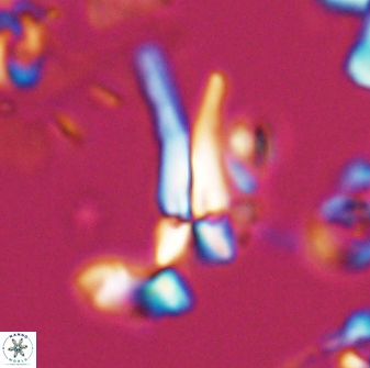 Sphenolithus furcatolithoides 25802