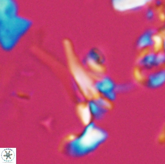 Sphenolithus furcatolithoides 25806