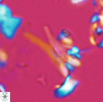 Sphenolithus furcatolithoides 25813