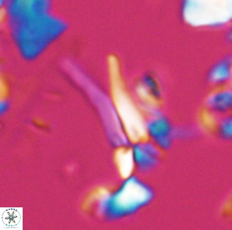 Sphenolithus furcatolithoides 25810