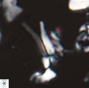 Sphenolithus furcatolithoides 25811