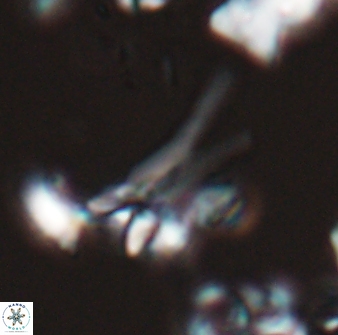 Sphenolithus furcatolithoides 25817