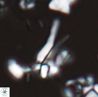 Sphenolithus furcatolithoides 25815