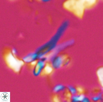 Sphenolithus furcatolithoides 25820