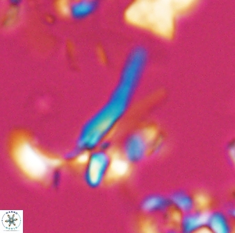 Sphenolithus furcatolithoides 25821