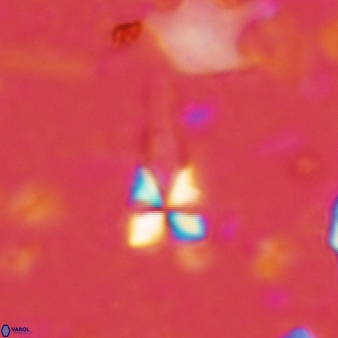 Sphenolithus heteromorphus 220