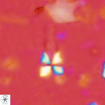 Sphenolithus heteromorphus 220