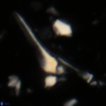 Sphenolithus heteromorphus 224