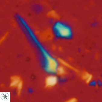Sphenolithus heteromorphus 225