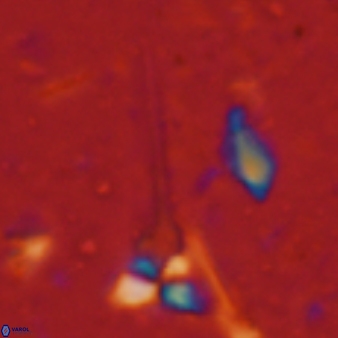 Sphenolithus heteromorphus 226