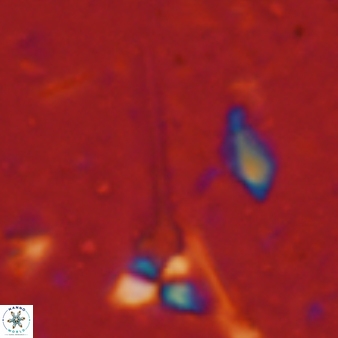 Sphenolithus heteromorphus 226