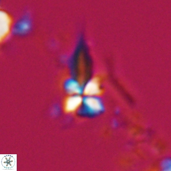 Sphenolithus heteromorphus 22715