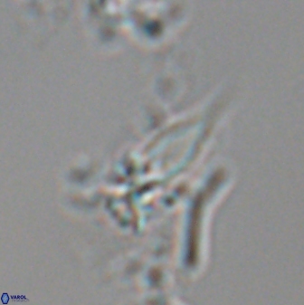 Sphenolithus heteromorphus 22719