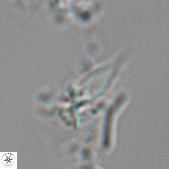 Sphenolithus heteromorphus 22719