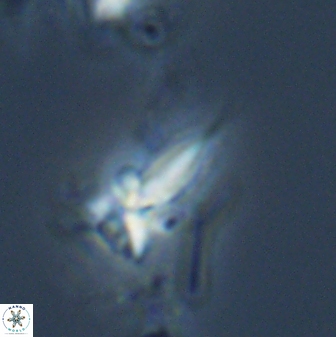 Sphenolithus heteromorphus 22720