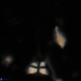 Sphenolithus heteromorphus 227