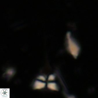 Sphenolithus heteromorphus 227