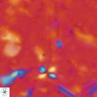 Sphenolithus heteromorphus 229