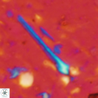 Sphenolithus heteromorphus 230
