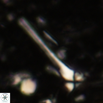Sphenolithus heteromorphus 232
