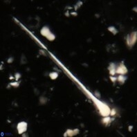 Sphenolithus heteromorphus 233a