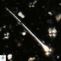 Sphenolithus heteromorphus 233a