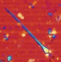 Sphenolithus heteromorphus 234a