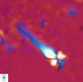 Sphenolithus heteromorphus 27681