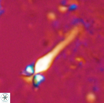 Sphenolithus heteromorphus 27687